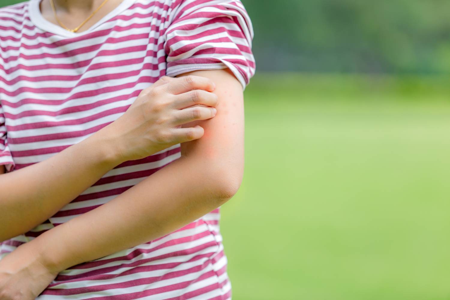 Women who are itching from insect bites in the grass. / Health care and medicine.